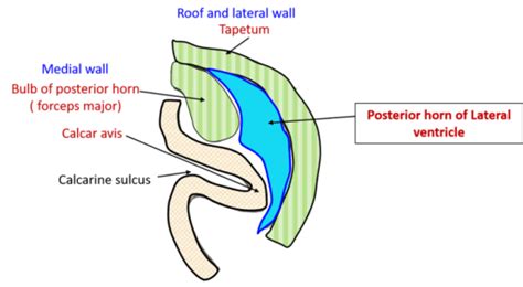 Lateral Ventricle Parts Boundaries Tela Choroidea Choroid Plexus