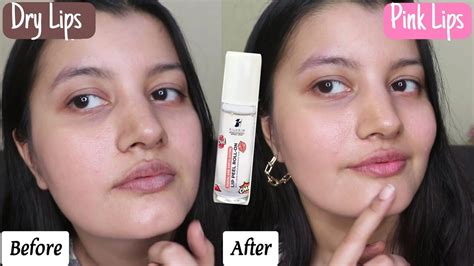 I Tried Chemical Peel On My Lips And This Happened Pilgrim Squalane Lip