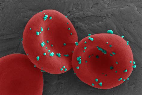 An Erythrocyte Mediated Immunotherapy To Leverage Lung Metastasis For