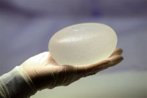 Reports Of Breast Implant Illnesses Prompt Federal Review The New The Best Porn Website