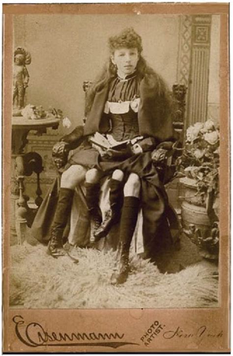 Myrtle Corbin Was A Four Legged Woman Who Had Five Kids Of Her Own