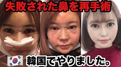 【比較画像】まりな（ヘラヘラ三銃士）の整形前後が別人？昔の写真と比べてみた！ コムドット＆youtuber研究所