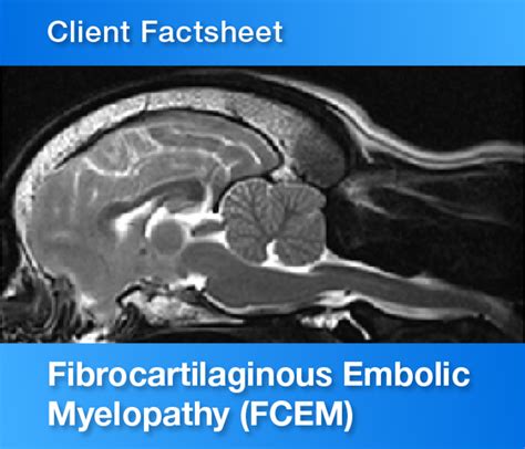 Fibrocartilaginous Embolic Myelopathy Factsheet Vet Oracle