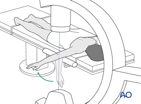 Prone Position