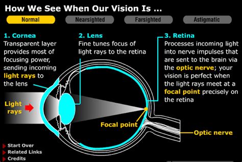 Bio Vision Educational Blog Human Eye How It Works Eye Disease Eye