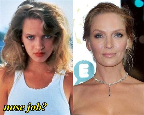 Uma Thurman Plastic Surgery Before And After Plastic Surgery Hits