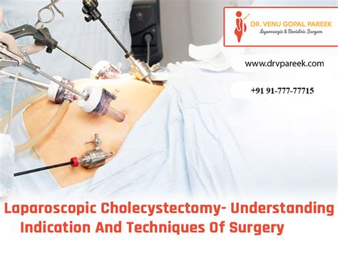 Laparoscopic Cholecystectomy Understanding Indication And Techniques