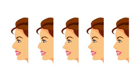 What Are The Different Types of Noses? | New Jersey gambar png