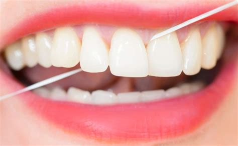 Estos Son Los Beneficios Del Uso De Hilo Dental Para La Salud Bucal
