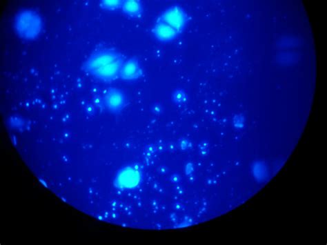 Mycoplasma Test With Dapi Can Anyone Please Comment On My