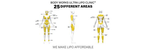 Bodyworks Ultralipo Clinic Services Bodyworks Ultra Lipo Clinic