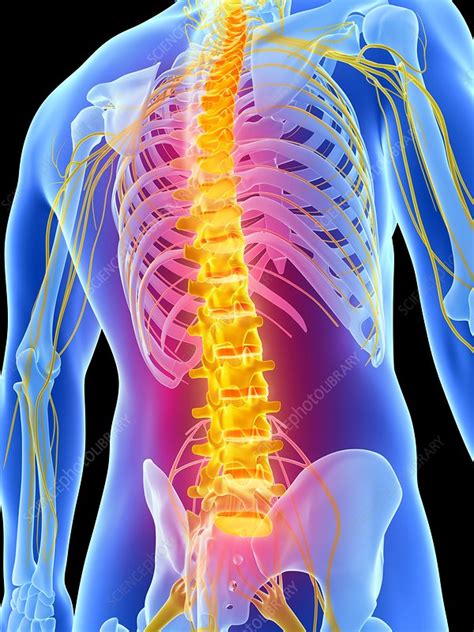 Human Back Pain Artwork Stock Image F0102186 Science Photo Library