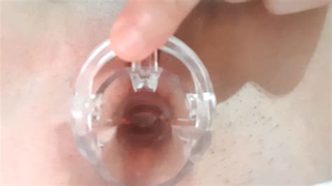 Gyno Pussy Exam And Humiliation Xhamster
