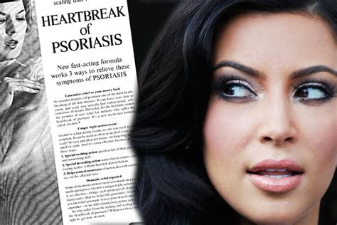 Kim Kardashians Psoriasis Is A Cultural Crisis