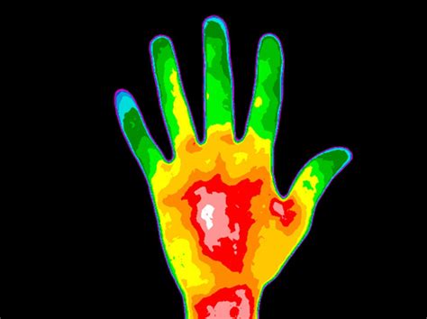 Um Today Rady Faculty Of Health Sciences Thermal Imaging May Detect