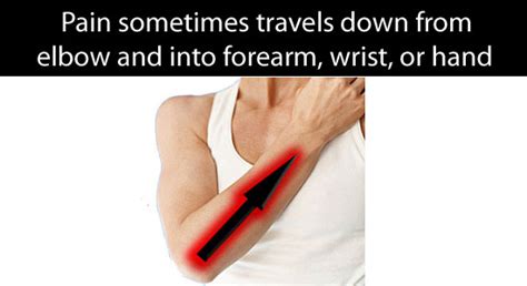 9 Tennis Elbow Symptoms You Should Never Ignore With Checklist