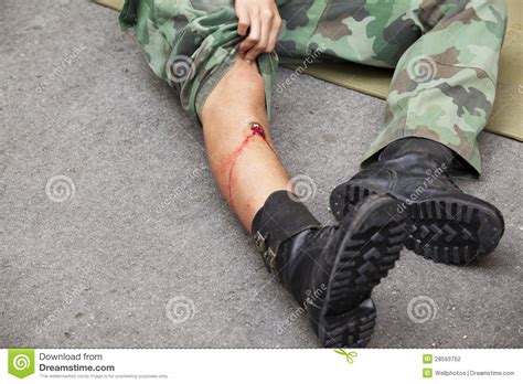 Gunshot Wound On Soldiers Leg Stock Photography Image