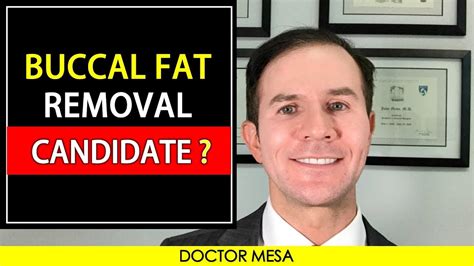 How To Know If You Are A Candidate For Buccal Fat Removal