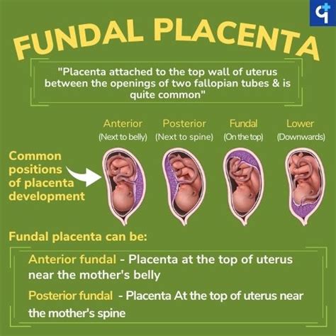 Fundal Placenta Types Position Complications