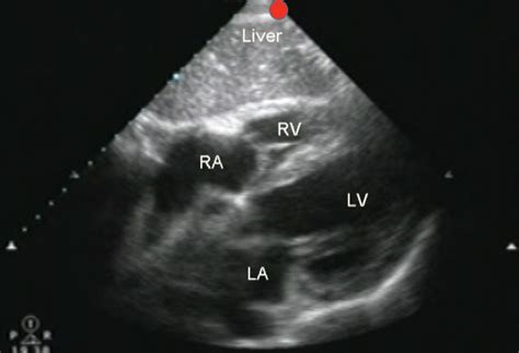 Introduction To Bedside Cardiac Ultrasound Jomi