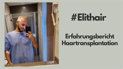 Meine Haartransplantation Erfahrung Elithair 1 YouTube