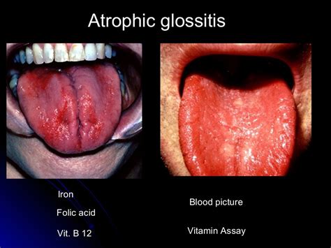 Oral Diagnosis And Systemic Diseases