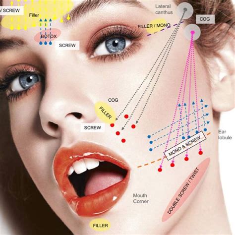 Facial Fillers Botox Fillers Dermal Fillers Aesthetic Medicine