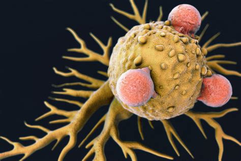 Poliovirus Kills Off Cancer Cells Stops Tumor Regrowth