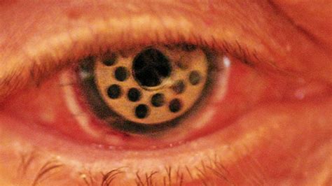 Trypophobia Holes In Eye