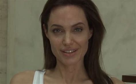 Заболевшая ветрянкой Анджелина Джоли показала как она выглядит ВИДЕО