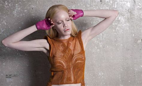 Albino Model Diandra Forrest Features In Fashizblack Magazine S