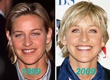 Ellen DeGeneres before and after plastic surgery (12) | Celebrity ...