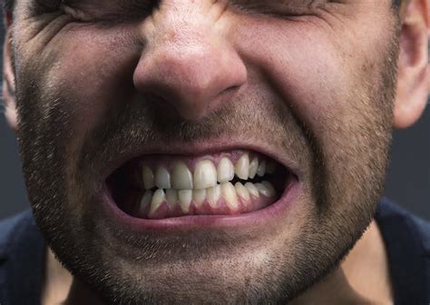 What Is Bruxism Tooth Grinding Of Course Catonsville Dental Care