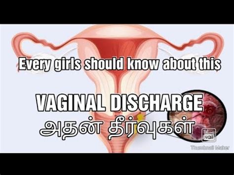 White Discharge In Women Is Normal Or Abnormal