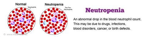 What Is Neutropenia Symptoms And Treatment Mediologiest