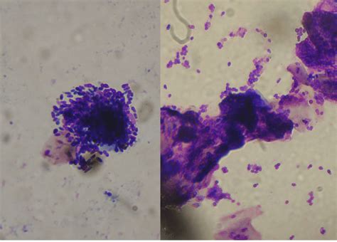 Cytology From Ear Discharge In Two Dogs With Malassezia Otitis Clumps