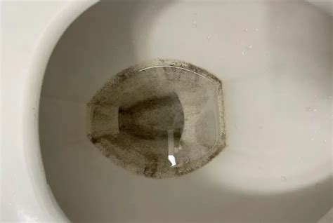 Black Spots In The Toilet Bowl Causes And Solutions