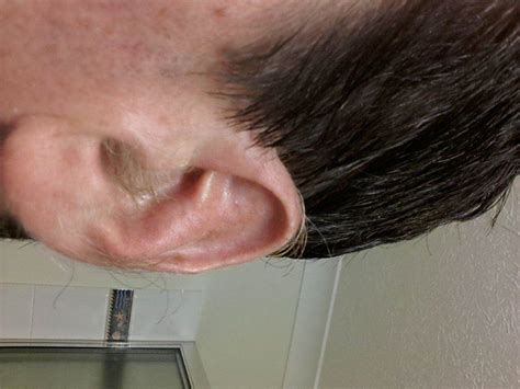 Other Ear Hair