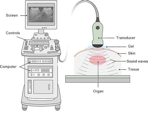 Ultrasound Machine Diagram