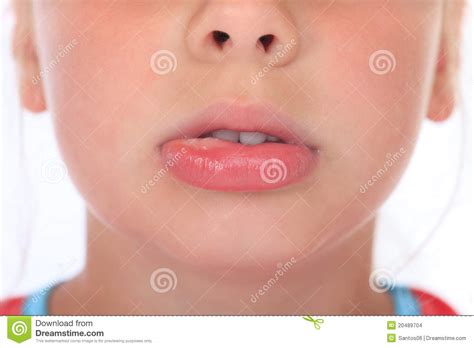 When in contact with certain foods or chemical, this can cause. Swollen Lip After Wasp Sting Stock Photo - Image of turgor ...