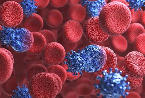 Hiv Cure A Second Patient Is In Long Term Remission After Stem Cell