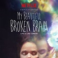 My Beautiful Broken Brain - Película 2014 - SensaCine.com.mx