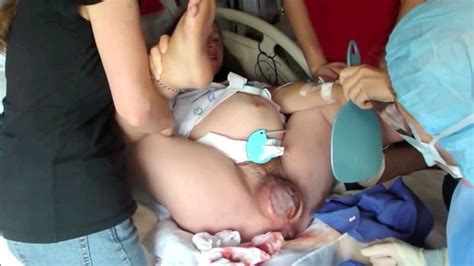 Asian Pussy After Birth