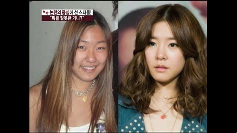 【tvpp】snsd Controversy Of Cosmetic Surgery 소녀시대 소녀시대 성형 논란 Section Tv Youtube