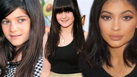 Kylie Jenner Has Aged Herself By A Decade After Fillers And Procedures