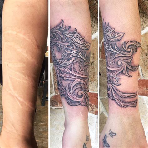 211 Amazing Tattoos That Turn Scars Into Works Of Art Bored Panda