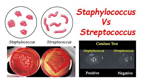 Differences Between Staphylococcus And Streptococcus Microbiology