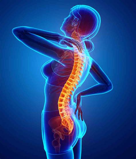 Back And Neck Pain Sol Physical Therapy