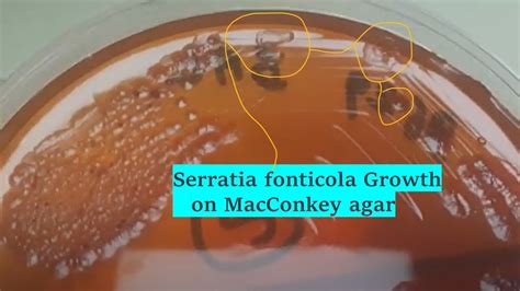 Serratia Fonticola Colony Morphology On Macconkey Agar Of Bal Sample