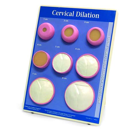 Cervical Effacement Dilation Model Childbirth Graphics